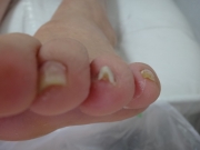 １ヶ月後　施術前　守山区