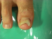 1ヶ月後　春日井市