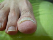 3ヵ月後　春日井市