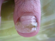 4ヵ月後　春日井市