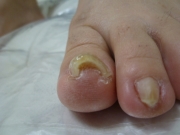 3ヶ月後　春日井市