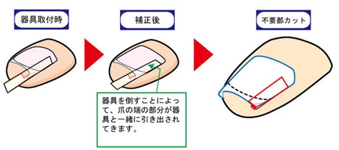 施術方法