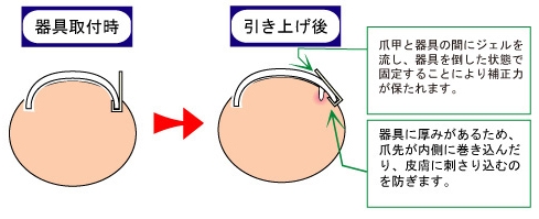 正面から見た状態